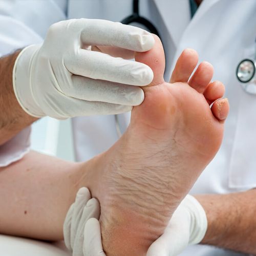 Mobile Foot Care Calgary
