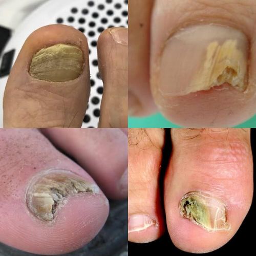 Mobile Foot Care Calgary